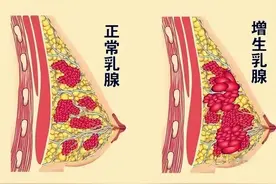 一味中成药，横扫身体内的痰湿、血瘀，能消掉80%的结节、囊肿！图片