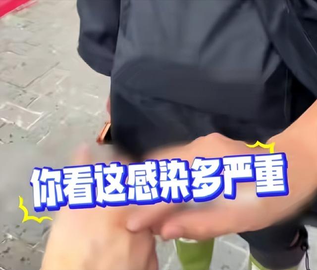 惊险！女子生理期潜水被鲨鱼咬伤，专家：血腥味有刺激