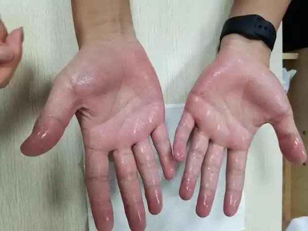 人活多久，看排汗就知道？寿命长的人，排汗一般或有这几个特征