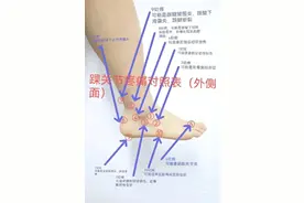 踝关节疼痛对照表~问题一目了然图片