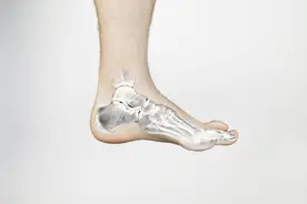 跟腱断裂术后为什么要康复训练？有哪些康复训练方法？图片