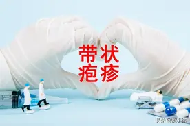 什么是带状疱疹？多久可以治愈？图片