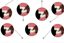 吸凉气就牙酸疼，不治可以吗？这五个原因看看是哪一个再决定图片