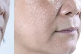 传统面相学认为，法令纹象征威严，从中医角度，我也来说说看法！图片