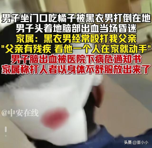 闹大了！男子家门口被打后续: 病危通知书，家属:不会和解，已立案