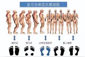 家长如何自查宝宝足踝问题图片