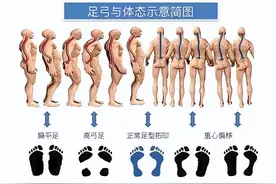 家长如何自查宝宝足踝问题图片