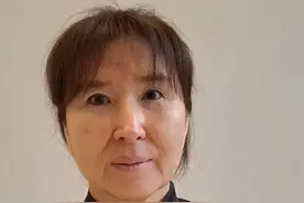 3个小时拉皮，躲在酒店恢复10天，回家之后儿子说：怎么换了个妈图片