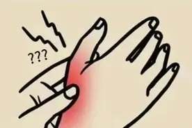 逃不掉的腱鞘炎，怎么预防？怎么治？图片