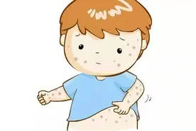 湿疹患者需谨慎，这些食物需远离：湿疹饮食禁忌详解图片