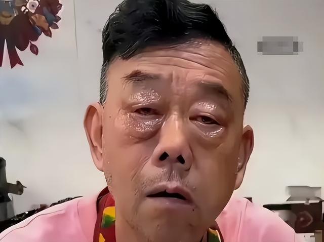 杨少华头七刚过，杨老三病重住院脸色极差，杨议漠不关心光顾着吃