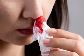 建议停止佩戴这东西，辐射超强，戴一天相当于做近百次胸片图片