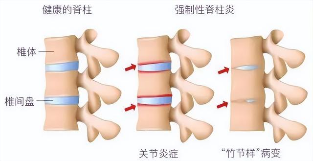 身价上亿有什么用？39岁患“不死癌症”的李宇春，给所有人提个醒