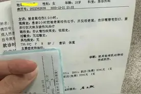 江苏一女子被老鼠咬后反咬回去！医生：当时我也蒙了图片