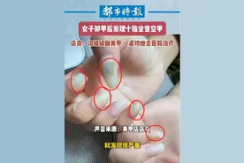 罕见！女生美甲后惊现空甲与绿脓杆菌，美甲店惊呼罕见！图片