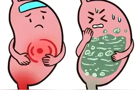 脾胃虚弱，消化不良，恶心呕吐、一个中成药，健脾养胃，助消化图片