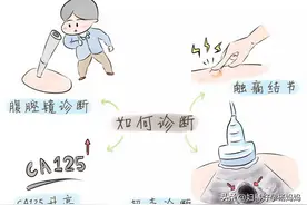 一味草药，号称“中药界的布洛芬”，是巧克力囊肿的天敌图片