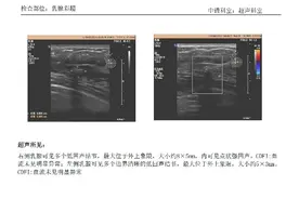 当爱康的体检结果和医院不一致时，你会选择怎么做？图片
