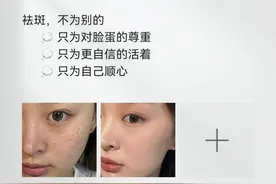 国药唯一承认的祛斑产品有哪几个？这几款性价比颇高图片