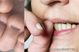 从小“咬指甲”的孩子，长大会怎样？逃不过3种结局，家长别大意图片