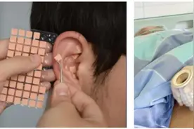 优质护理服务系列⑤ | 中医外治助健康 优质服务暖身心图片
