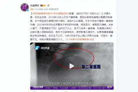 男孩做阑尾切除术5年后阑尾还在!家属:当时切了吗?切的什么?图片