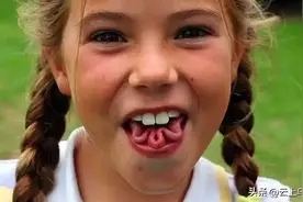 10种罕见的人体特征，拥有一个或是“天选之人”，看你占了几种？图片