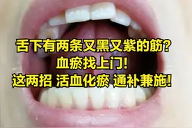 舌下有两条又黑又紫的筋？血瘀找上门！这两招 活血化瘀 通补兼施！图片