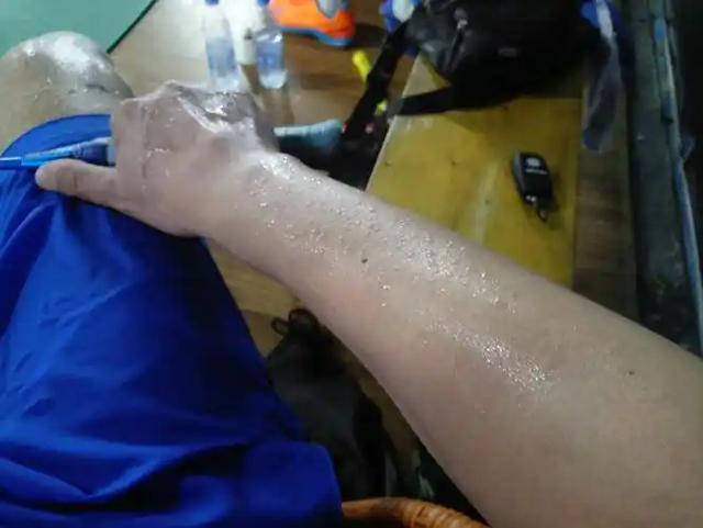 人活多久，看排汗就知道？寿命长的人，排汗一般或有这几个特征