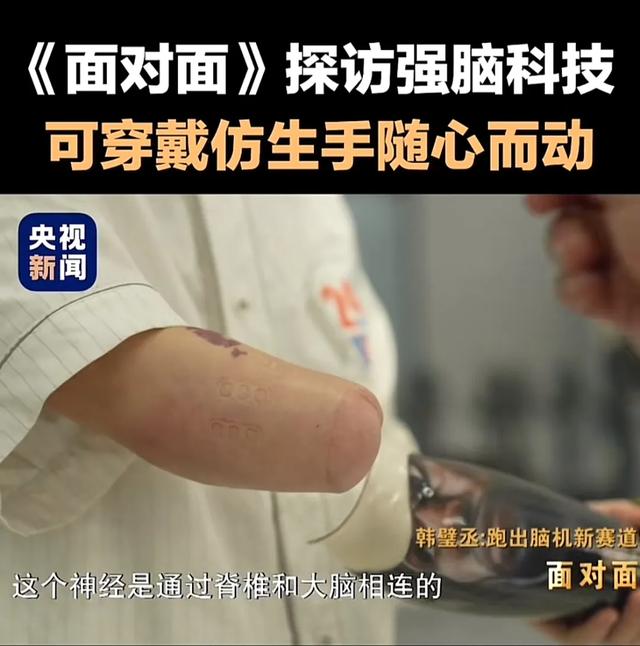 Nature顶刊发布，一文看懂Meta新技术“肌电手环sEMG”
