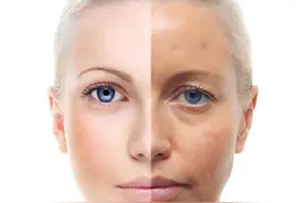 40岁后还想变年轻，三甲医生绝不会告诉你的五个抗衰项目！图片