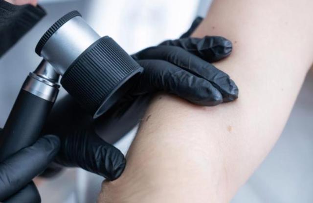 只要记住这3个关键点，湿疹很快就好了，皮肤慢慢变干净！