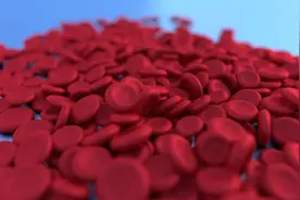 血液粘稠，身体可能会有3个表现，不妨自查一下图片