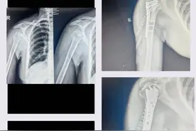 年度记忆 | 技术攻关 “医”路创新图片