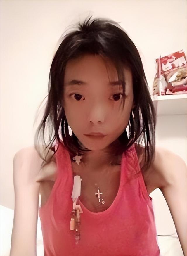 豪门玩物，几年被折磨成牙齿全脱落，不足80斤，似骷髅，惨不忍睹