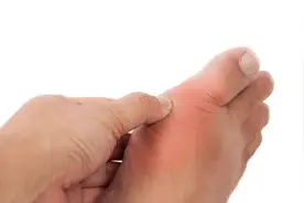 一80后男子 突然瘸腿，原因竟是…………家里有脚疼的要注意了图片