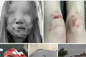移英港女，街头被暴打图片