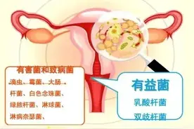 干货，不同类型的阴道炎，用药总结图片