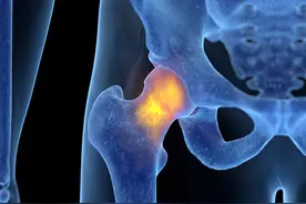 股骨头坏死的一个外敷方，希望能够帮助到大家图片