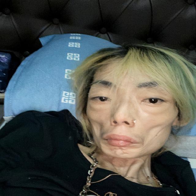 一代女神沦为豪门玩物？结婚8年牙齿全掉，器官切除，面似骷髅