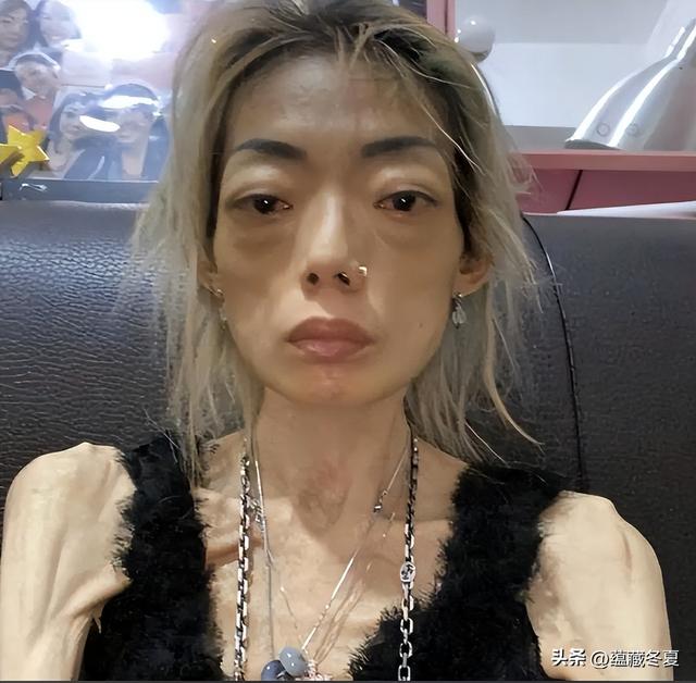 一代女神沦为豪门玩物？结婚8年牙齿全掉，器官切除	，面似骷髅