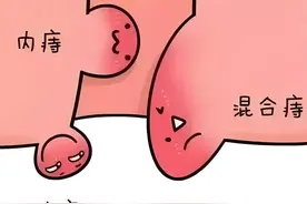 十人九痔？大多源于内热；1个中成药，凉血清热，缓解痔疾之痛图片