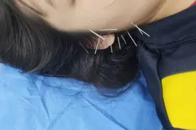 长春市妇产医院推出颊针疗法治疗，为女性经期健康保驾护航图片