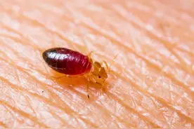 床虱是什么原因长出来的？什么原因会导致床虱的出现？图片