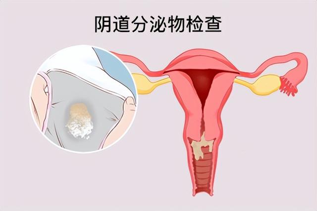 怀孕初期见红，是先兆流产吗？该怎么应对？