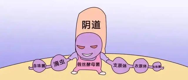 发生霉菌性阴道炎，注意这4点症状，医生告知：治疗做到这6点