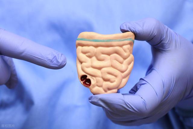 柿子立大功？浙大研究发现：柿子可在36小时清除27%有害菌群？