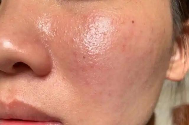 这5种妇科病属于激素依赖型，不用药就能自愈！妇科医生说出实情