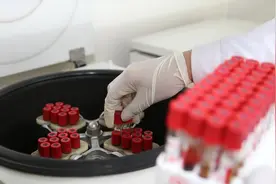 胆红素升高到多少有危险，各种胆红素，都代表了什么？图片