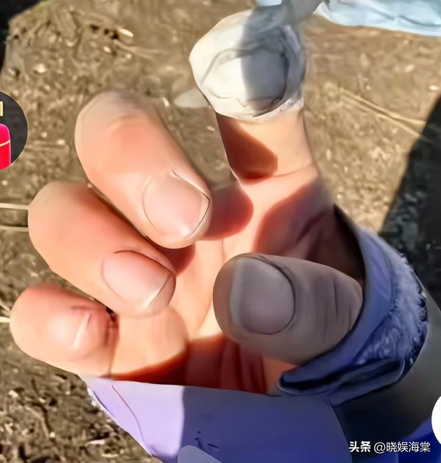 登山网暴救命搭子后续：为救人手废了，女子身份被扒，全程作死